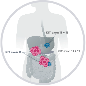 About GIST Mutations